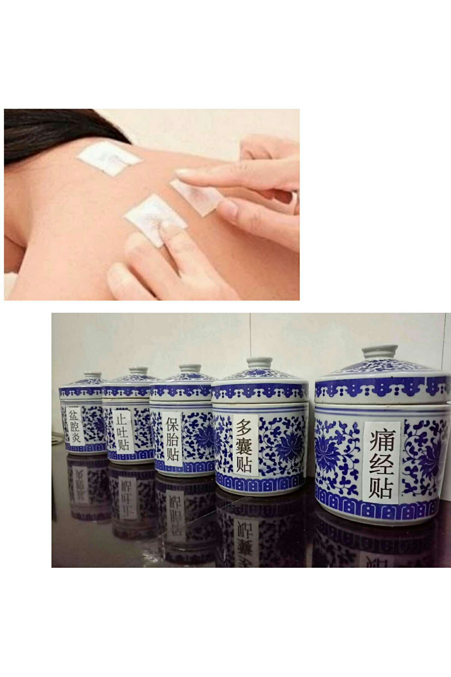 1、三伏貼能治什么病？