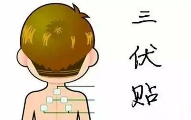 1、“兒童三伏貼”能讓孩子少生病嗎？爸爸媽媽不再盲目跟風(fēng)了。