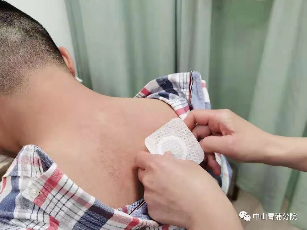 2、江西兒童貼三伏貼癢灼痛，什么體質(zhì)的人可以貼三伏貼癢灼痛？