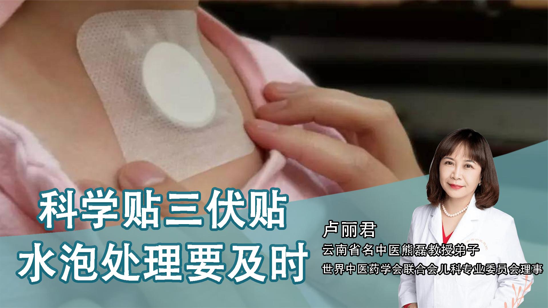 2、貼三伏貼后有什么禁忌？