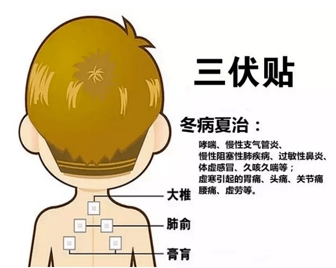 1、三伏貼多大？寶寶能貼多少？</p><p>三伏貼孩子貼多久？
