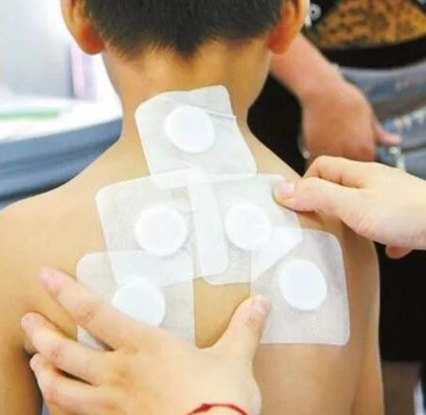 2、三伏貼在脖子上，有一根針，看起來(lái)很疼。怎么了